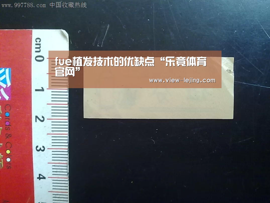 fue植发技术的优缺点“乐竟体育官网”(图1) 乐竟体育官网